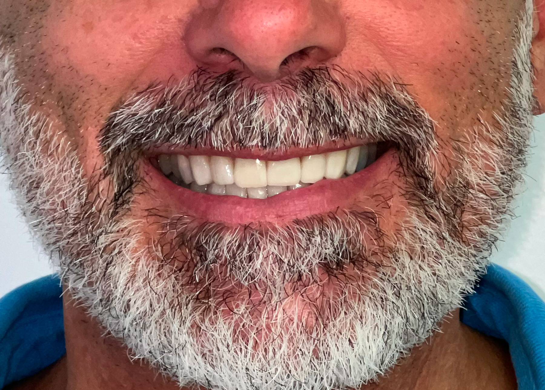 Fabio post_v1